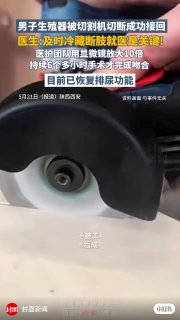 医生：及时冷藏断肢就医是关键！